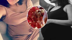 Two Pregnant Minors Found in Child Marriage Cases in Hamirpur’s Nadaun
