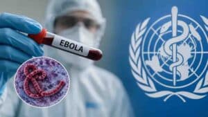 Gujarat Reports First Suspected Ebola Case Amid Rising Cases in Africa