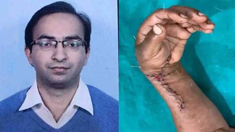 AIIMS Bilaspur Surgeons Reattach Severed Hand in Historic 7-Hour Operation