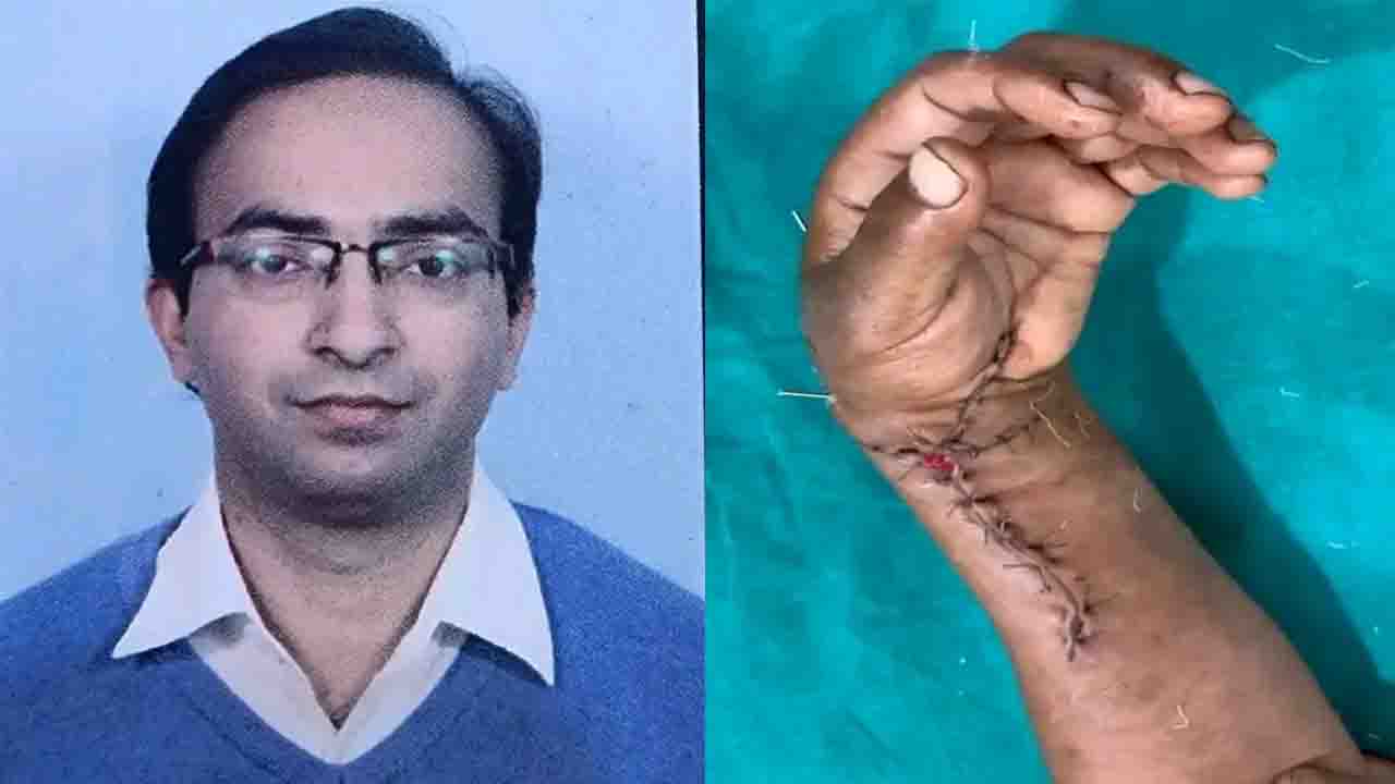 AIIMS Bilaspur Surgeons Reattach Severed Hand in Historic 7-Hour Operation