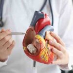 Not Just Smoking: Top Heart Surgeon Outlines 5 Daily Habits Threatening Cardiac Health
